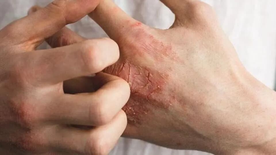 نمونه برداری از ضایعات پوستی