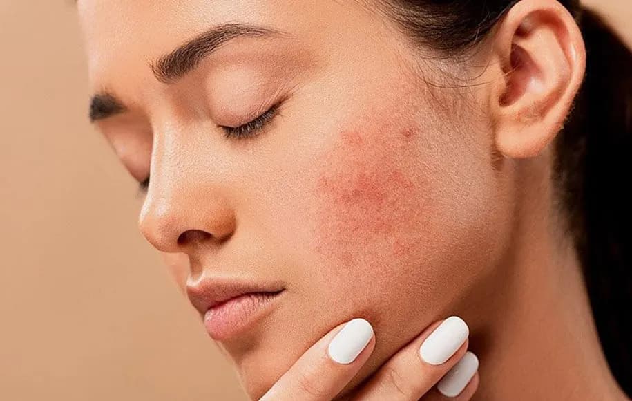 تاثیرات هورمون روی پوست