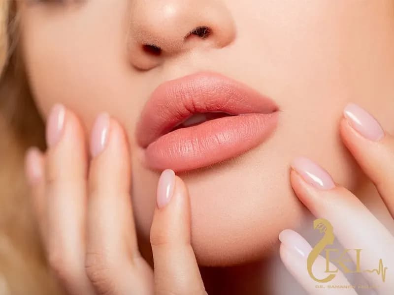 تزریق ژل لب مدل قلوه ای