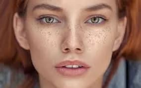 لک پوستی چگونه ایجاد می شود؟