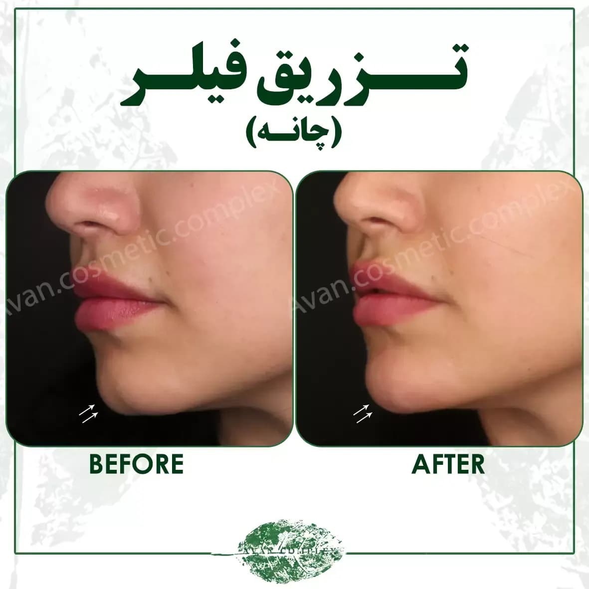 کلینیک زیبایی در تهران
