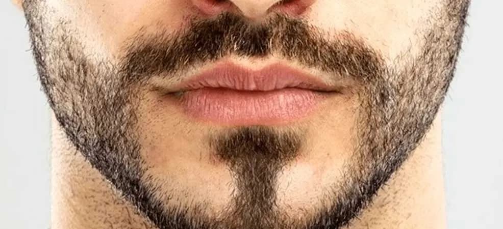 تغییر رنگ مو و ریش بعد از بلوغ