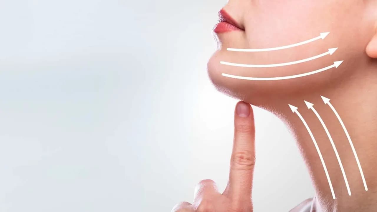 لیفت با نخ یا هایفوتراپی