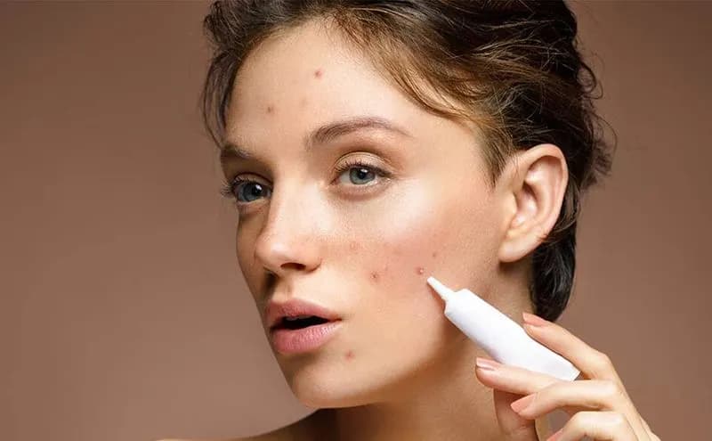 بهترین روش های از بین بردن جای جوش