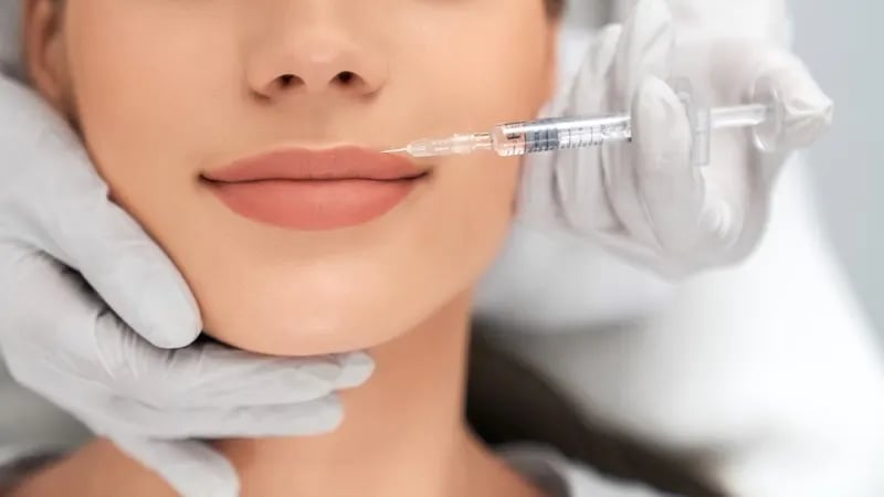 تزریق ژل لب مدل چاک‌دار
