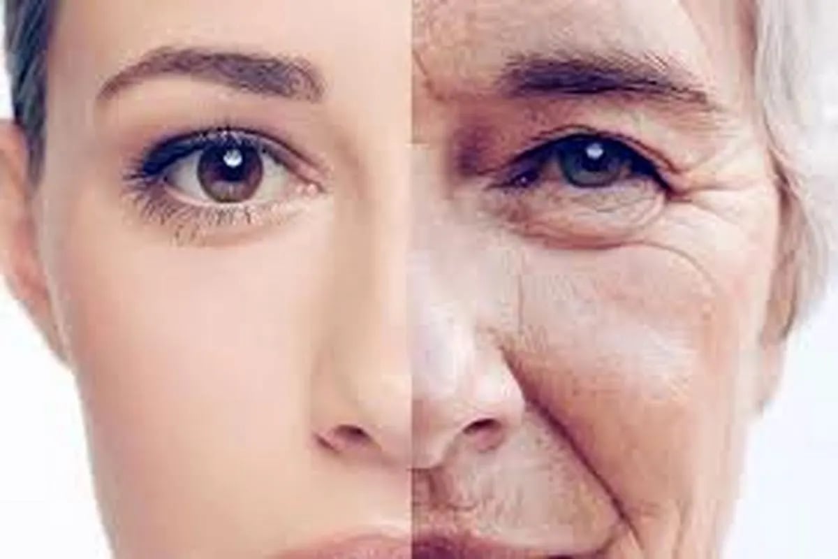 عوارض بوتاکس