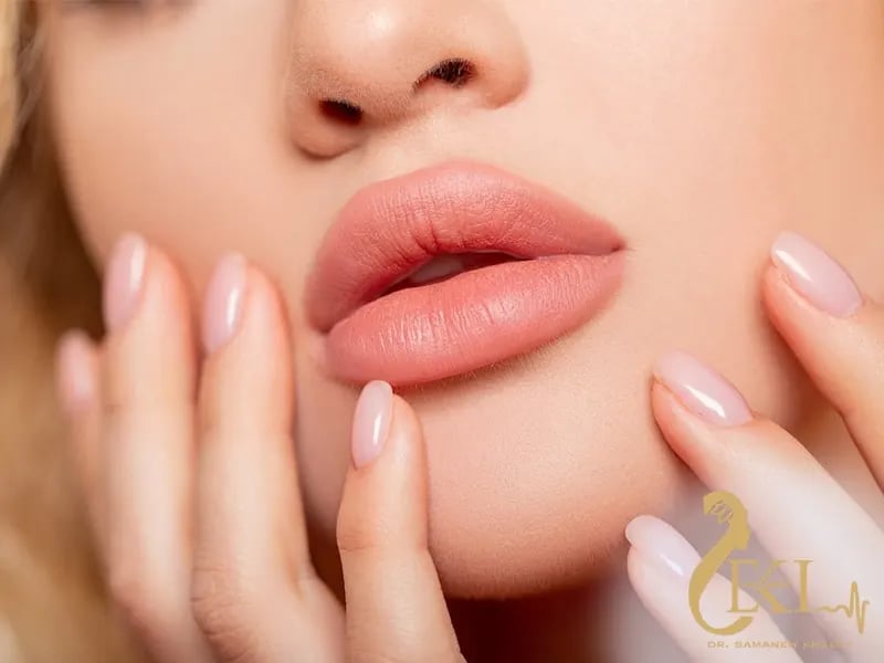 تزریق ژل لب مدل قلوه ای