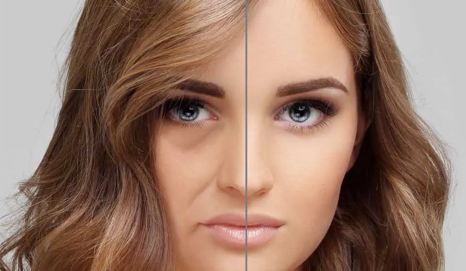 تزریق میدفیس