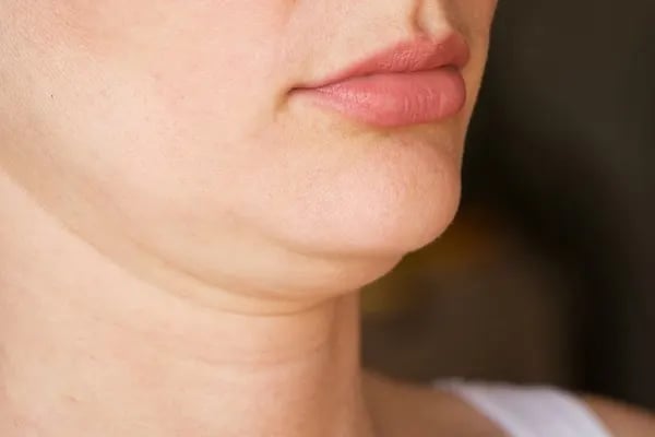 روش های از بین بردن غبغب