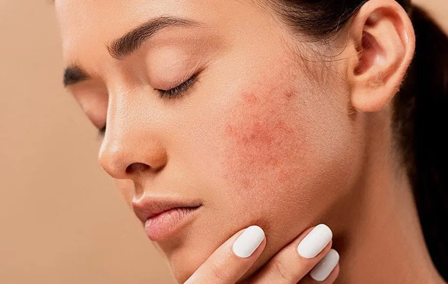 تاثیرات هورمون روی پوست