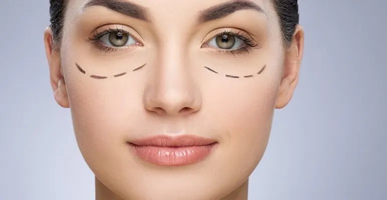 مزوتراپی دور چشم