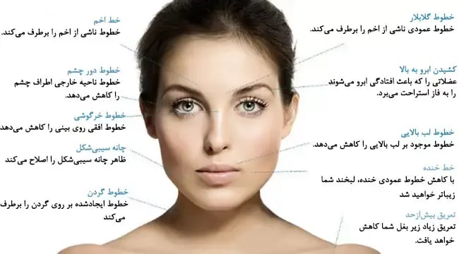 سوالات رایج در مورد بوتاکس
