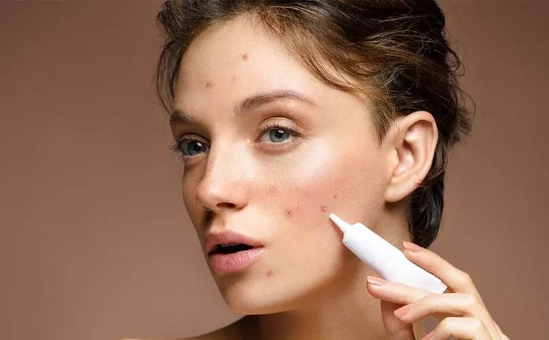 بهترین روش های از بین بردن جای جوش