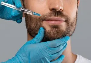 تزریق ژل لب در آقایان