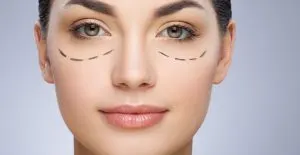 مزوتراپی دور چشم