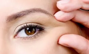 کاربرد لیفت شقیقه با ژل
