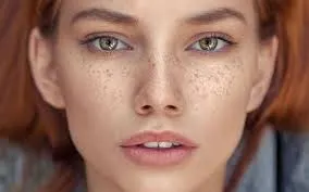 لک پوستی چگونه ایجاد می شود؟