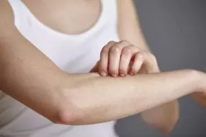 ماستوسیتوز