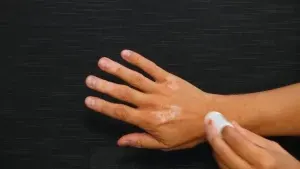 تفاوت قارچ پوستی با پیسی