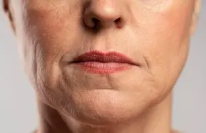 عوارض بی خوابی روی پوست