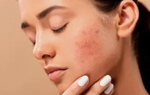 تاثیرات هورمون روی پوست