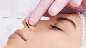 رفع قوز بینی با نخ
