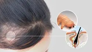 دمودکس چیست؟