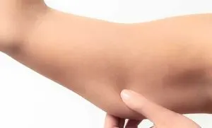 پیشگیری از افتادگی پوست بعد از لاغری