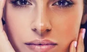 متخصصین پوست چه کارهایی نمیکنن؟!