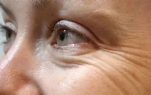 خطوط پنجه کلاغی