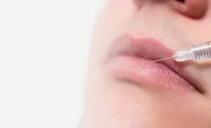 عفونت لب بعد از تزریق فیلر