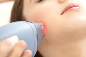 لیزر موهای زائد صورت