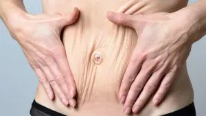 عوارض لاغری بر پوست